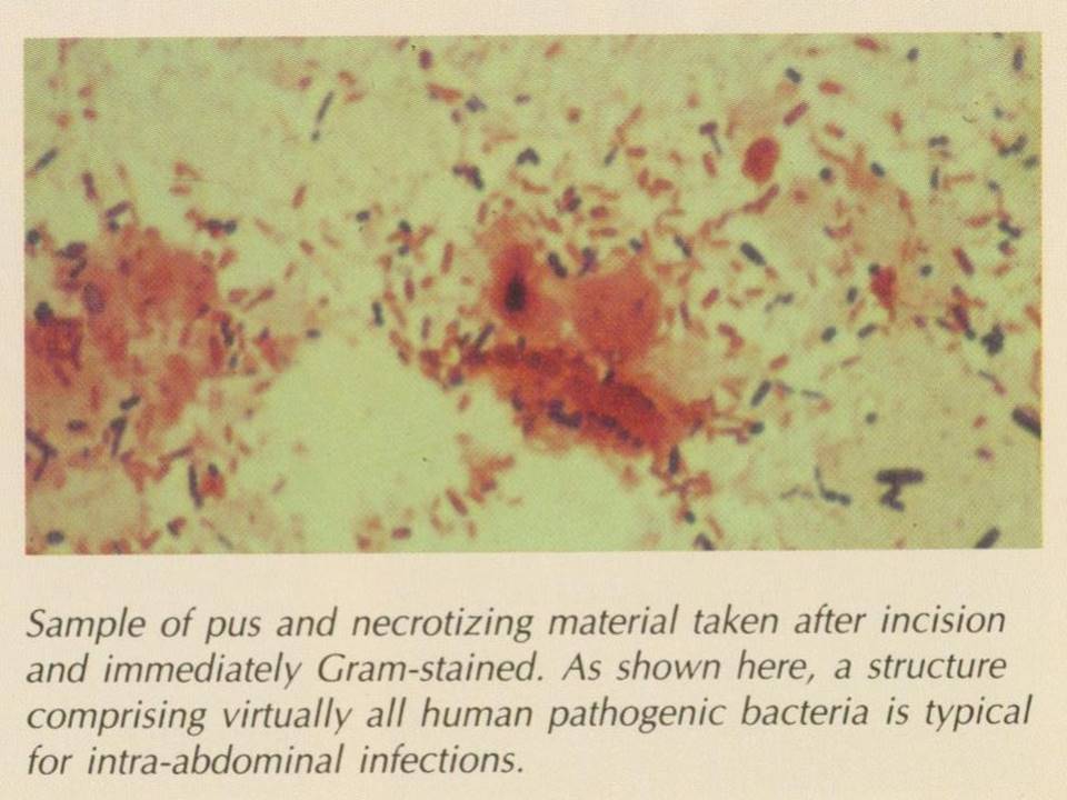 gram stain